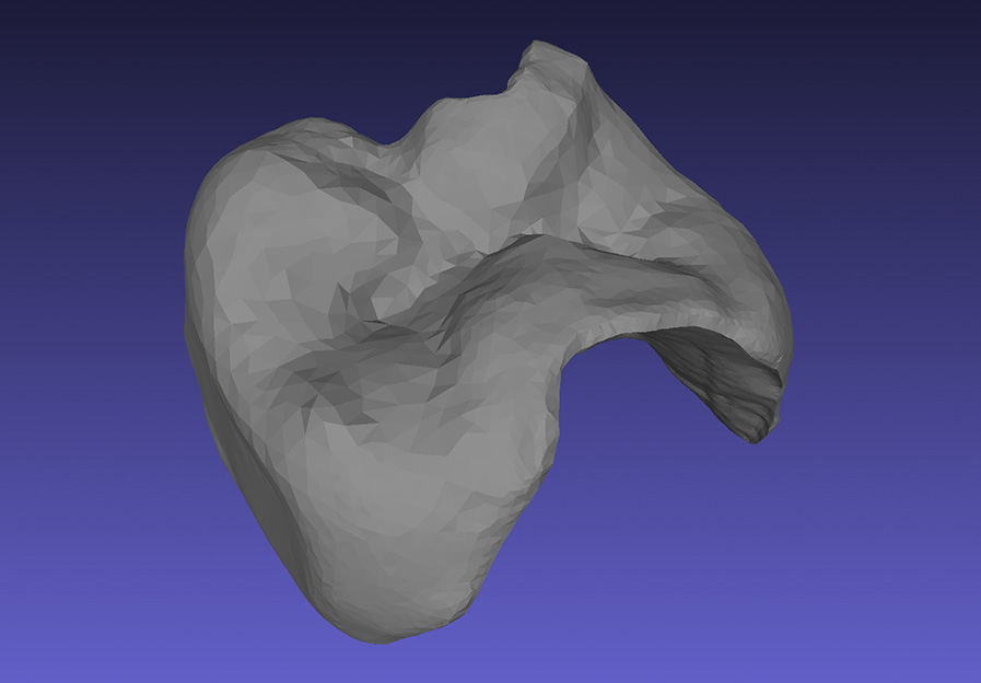 3D Datensatz des Inlays