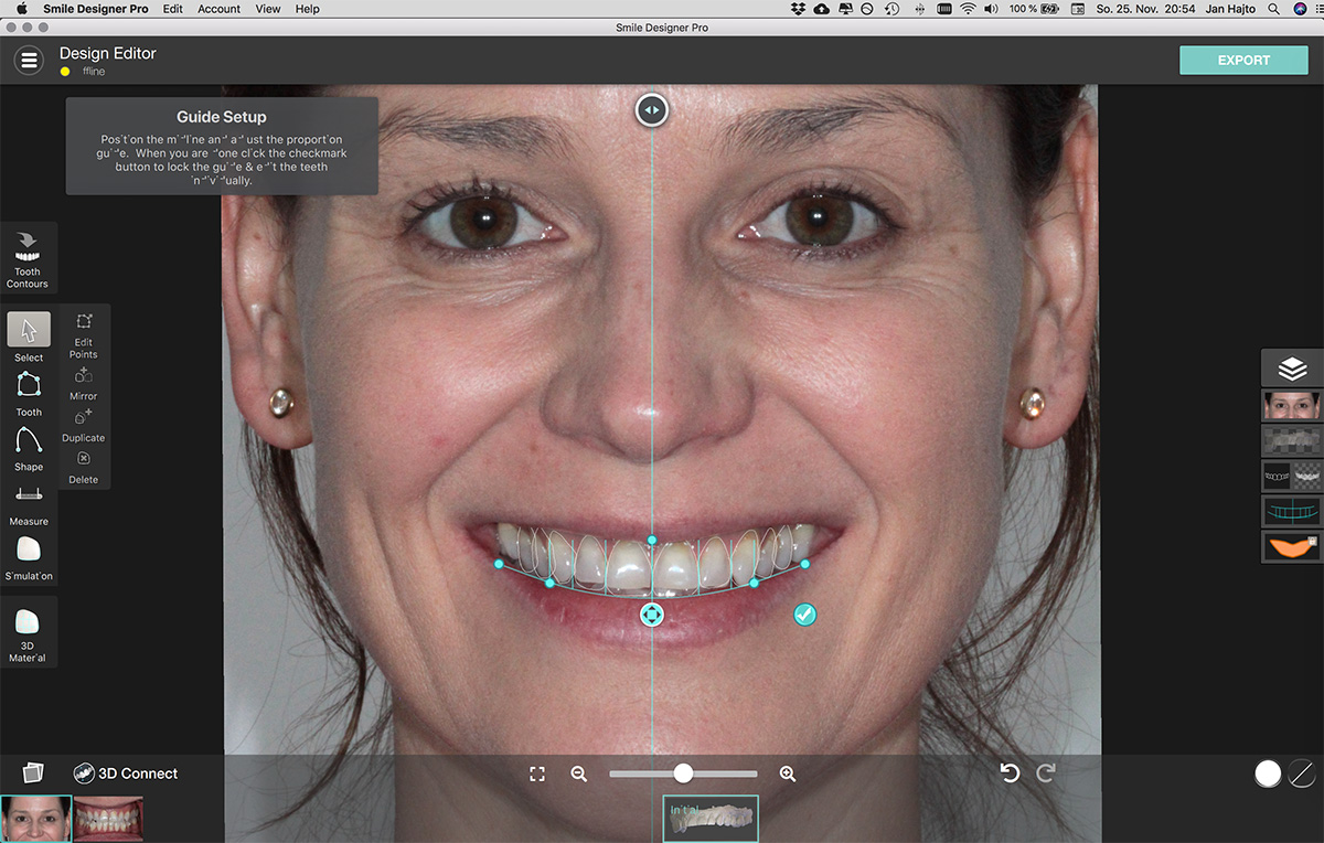 Digital Smile Design Digital Smile Design