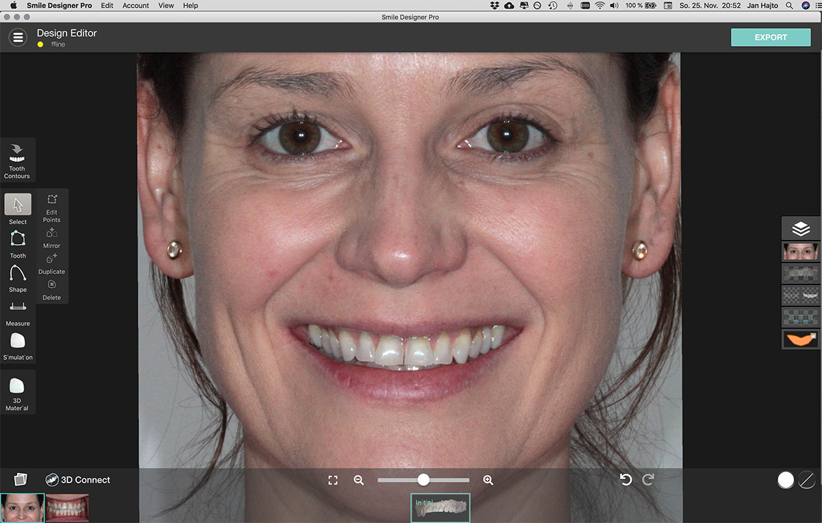 Smile Design Ausgangssituation Smile Design Ausgangssituation