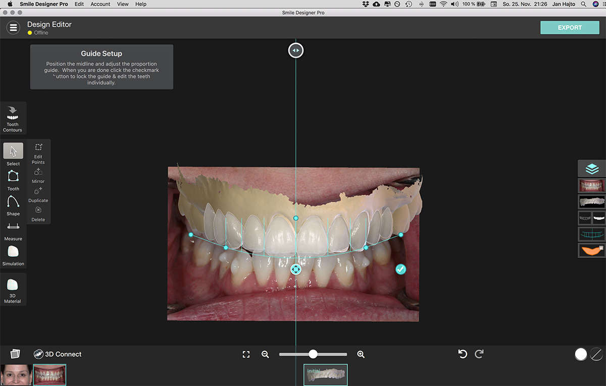 Smile Design Interorale Aufnahme und 3D Scan Smile Design Interorale Aufnahme und 3D Scan