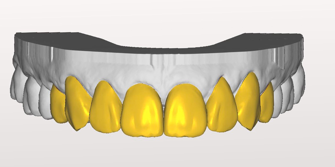 Digitale Modellation Digitale Modellation