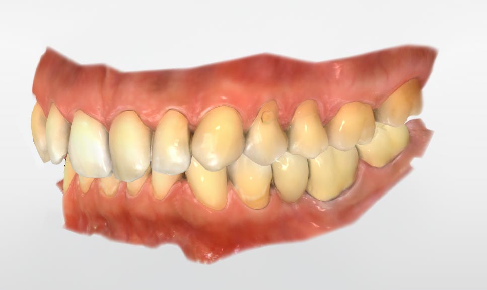 Intraoralscanner Sirona Primescan